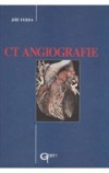 CT angiografie