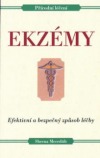 Ekzémy