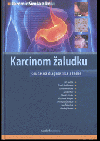 Karcinom žaludku