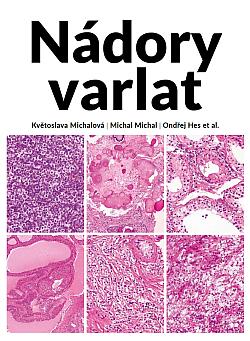Nádory varlat
