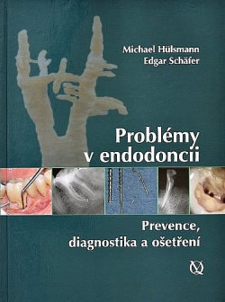 Problémy v endodoncii