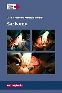 Sarkomy