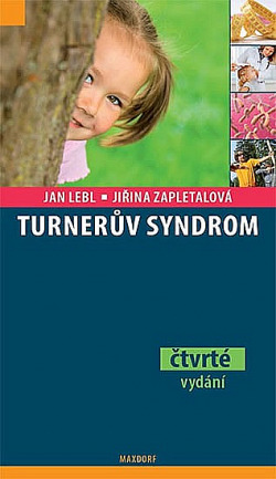 Turnerův syndrom