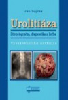 Urolitiáza