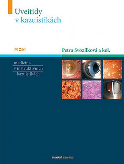 Uveitidy v kazuistikách
