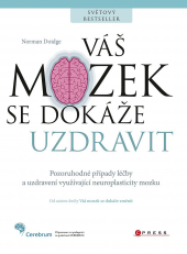 Váš mozek se dokáže uzdravit