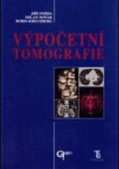 Výpočetní tomografie