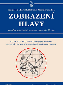 Zobrazení hlavy